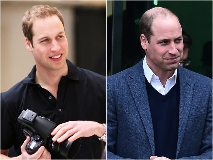 Hoàng tử William kết hôn với Công nương Kate Middleton tại Tu viện Westminster vào năm 2011. Có thể nhận thấy rõ sự thay đổi về ngoại hình của vị hoàng tử này trong 10 năm qua.