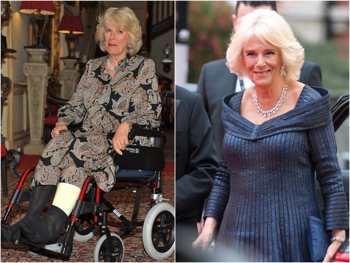 Công nương Camilla, vợ của Thái tử Charles, được nhìn thấy ngồi xe lăn hồi năm 2010. Hiện tại, trông bà rất khỏe mạnh và hạnh phúc.
