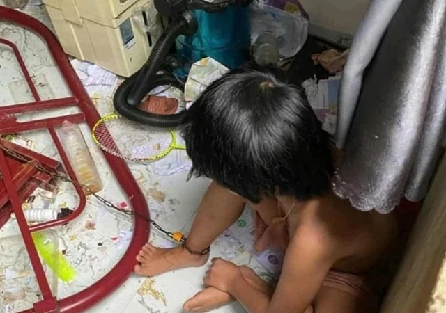 Đắk Lắk: Giám định thương tật hai bé gái bị cha ruột nhốt, xích chân