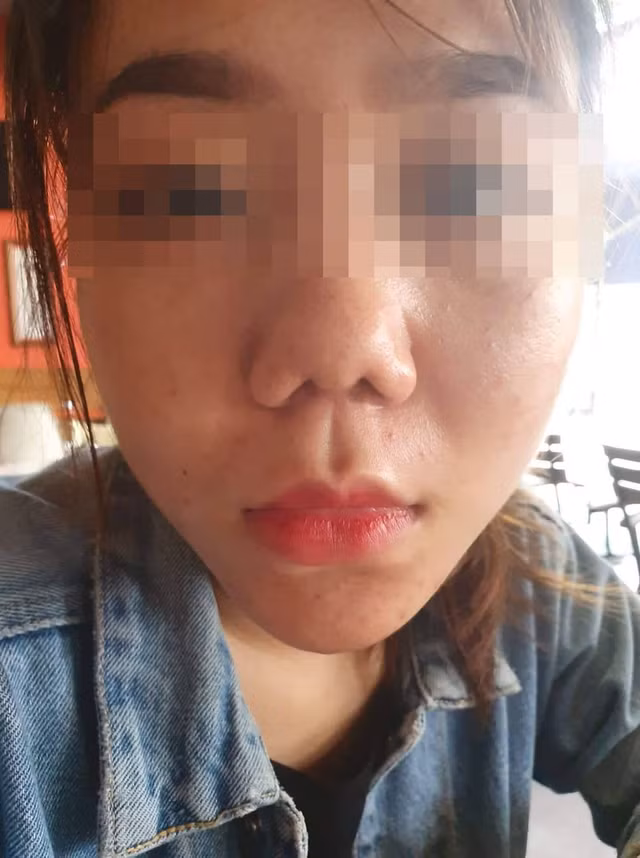 Vụ khách hàng tố Klain Beauty Center làm hỏng mũi: Công ty TNHH Klain bị phạt vì dính nhiều vi phạm - Hình 2 Vu khach hang to Klain Beauty Center lam hong mui: Cong ty TNHH Klain bi phat vi dinh nhieu vi pham-Hinh-2
