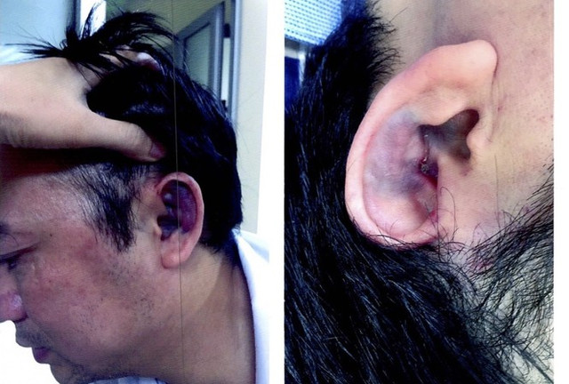 Tổng giám đốc và Chủ tịch HĐQT tẩn nhau ở công ty, 1 người nhập viện Tong giam doc va Chu tich HDQT tan nhau o cong ty, 1 nguoi nhap vien