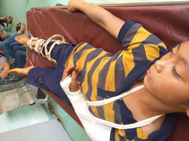 Bé trai 11 tuổi bị hàng xóm đánh trọng thương, gãy một tay Be trai 11 tuoi bi hang xom danh trong thuong, gay mot tay