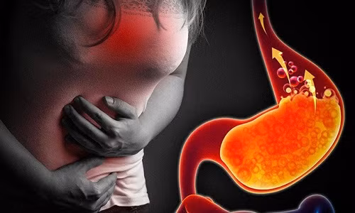 Ngoài ra, một số trường hợp ít gặp, những người bị trào ngược dạ dày thực quản hoặc những người mắc hội chứng tự sinh rượu - auto-brewery syndrome (còn gọi là hội chứng say xỉn không do uống rượu) cũng có thể có kết quả dương tính khi kiểm tra nồng độ cồn. Ảnh: Internet.