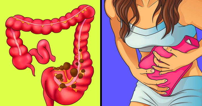 Chườm ấm: Đặt túi chườm nóng lên vùng bụng có thể giúp thư giãn cơ bắp, giảm đau dạ dày, căng thẳng và chuột rút. Bạn cũng có thể sử dụng một chai nước nóng, chăn điện nóng,... Đặt nó lên phần dạ dày của bạn trong vài phút để cảm thấy dễ chịu hơn.