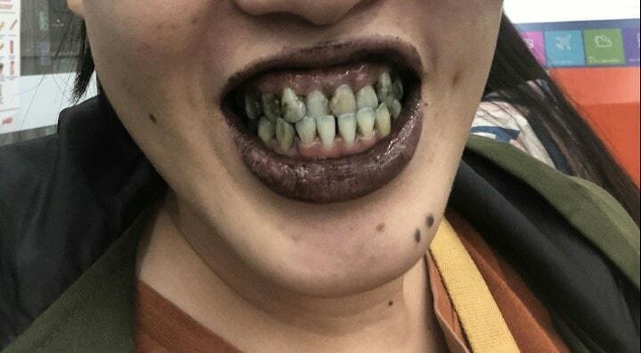 Trào lưu kem đen có thành phần than hoạt tính hay còn gọi là tinh than khởi nguồn từ quán Ice Cream Finest Morgenstern ở New York, Mỹ: kem “black coconut ash” với thành phần tinh than dừa. Ngay sau khi xuất hiện, món kem đen này trở thành hiện tượng và ngập tràn trên Instagram.