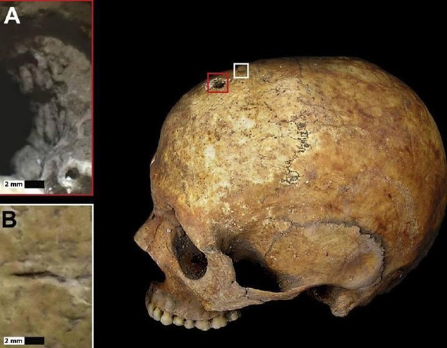 Kết quả kiểm tra cho thấy hài cốt hai mẹ con trên có niên đại từ thế kỷ thứ 7-8 trước công nguyên.