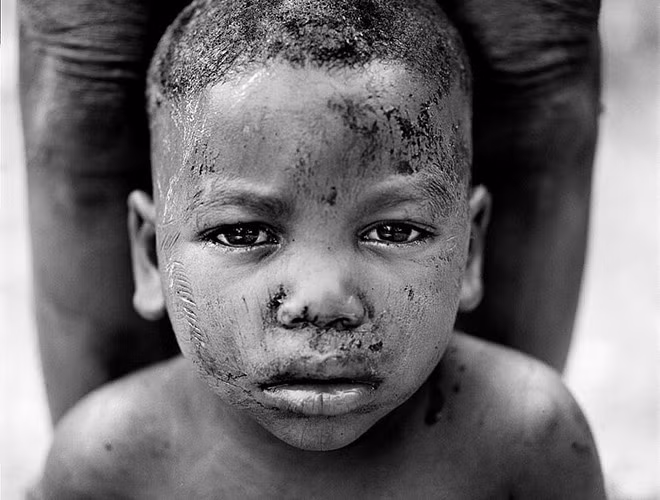 Tại nhiều bộ lạc ở Tây Phi, việc rạch mặt hay cơ thể để tạo sẹo là hình thức đánh dấu tuổi trưởng thành. Nếu như người dân quốc Papua New Guinea, họ khắc lên da những hình xăm giống vảy cá sấu thì người dân ở bộ lạc Betamarrine lại cho rằng việc rạch lên mặt những đứa trẻ là nghi lễ chứng minh sự trưởng thành.