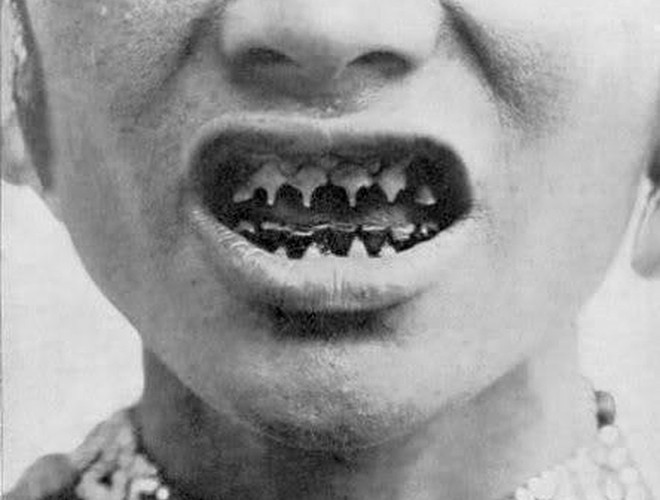 Ngoài quan niệm chứng minh cho sự trưởng thành, những chiếc răng nhọn còn thể hiện chuẩn mực vẻ đẹp của người phụ nữ tại bộ tộc Mentawai. Người phụ nữ nào có hàm răng càng nhọn thì càng đẹp và có giá trị. Người đàn ông nào cưới được cô gái có hàm răng càng nhọn thì càng được đánh giá cao.