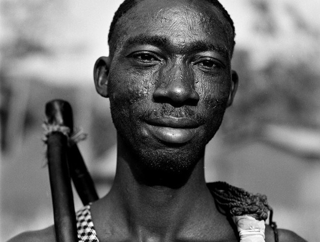 Những vết sẹo trên mặt được coi là minh chứng cho sự trưởng thành, nam tính và bản lĩnh của các chàng trai. 