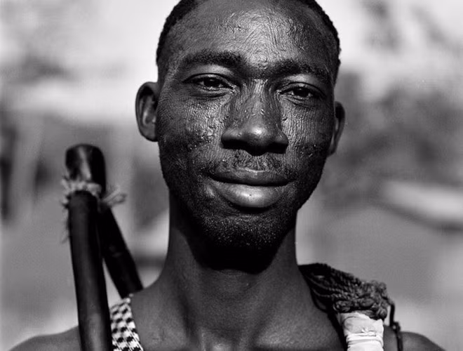 Những vết sẹo trên mặt được coi là minh chứng cho sự trưởng thành, nam tính và bản lĩnh của các chàng trai. 