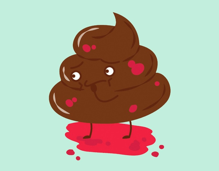 Phân có máu: Nếu đi đại tiện thấy có máu trong phân thì có thể bạn đã bị viêm đại tràng. Nếu bạn thấy máu sẫm màu, gần như đen, trong phân hoặc nếu bạn bị tiêu chảy ra máu, bạn cần đi khám bác sĩ càng sớm càng tốt. Đó có thể là bệnh Crohn, viêm loét đại tràng hoặc trong trường hợp xấu nhất là ung thư.