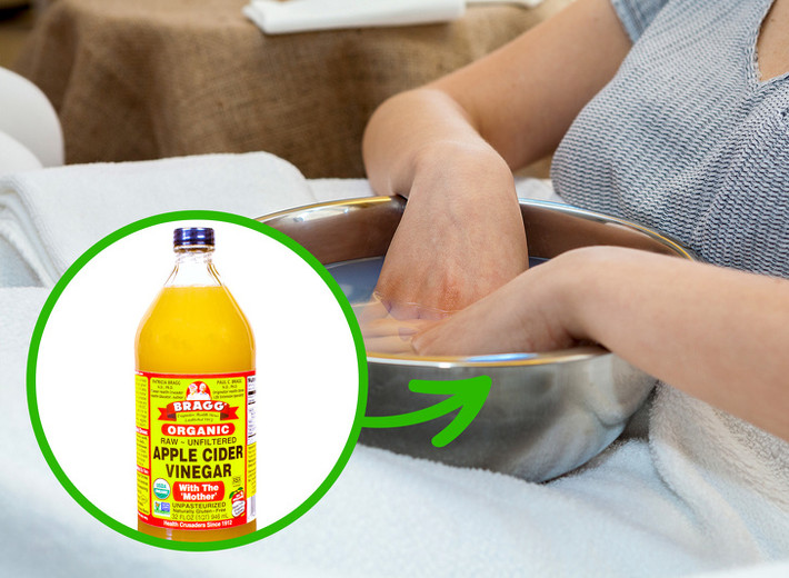 Giấm táo chữa nhiễm trùng ngón tay: Ngâm tay, chân trong chậu nước ấm pha giấm táo khoảng 15 - 20 phút có thể giúp bạn điều trị tình trạng nấm móng thể nhẹ. Ngoài ra, cách này cũng giúp thư giãn và hỗ trợ lớp sừng của móng tay, móng chân phát triển khỏe mạnh hơn.