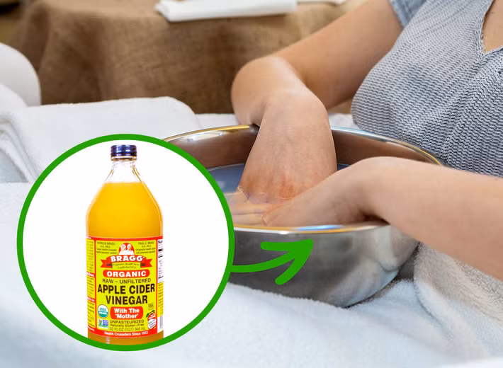 Giấm táo chữa nhiễm trùng ngón tay: Ngâm tay, chân trong chậu nước ấm pha giấm táo khoảng 15 - 20 phút có thể giúp bạn điều trị tình trạng nấm móng thể nhẹ. Ngoài ra, cách này cũng giúp thư giãn và hỗ trợ lớp sừng của móng tay, móng chân phát triển khỏe mạnh hơn. 
