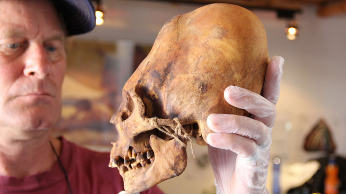 Một điều kỳ lạ nữa là những hộp sọ Paracas chỉ có một lớp xương đỉnh sọ thay vì hai lớp như thường thấy ở người.