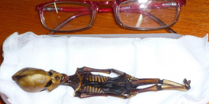 Với vóc dáng nhỏ, xác ướp Atacama khiến dư luận đặc biệt quan tâm bởi có hộp sọ dài, hốc mắt lớn nhưng thiếu xương sườn.