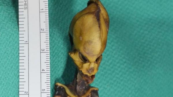 Với kết quả nghiên cứu này, các chuyên gia bác bỏ giải thuyết xác ướp Atacama là thi thể người ngoài hành tinh.