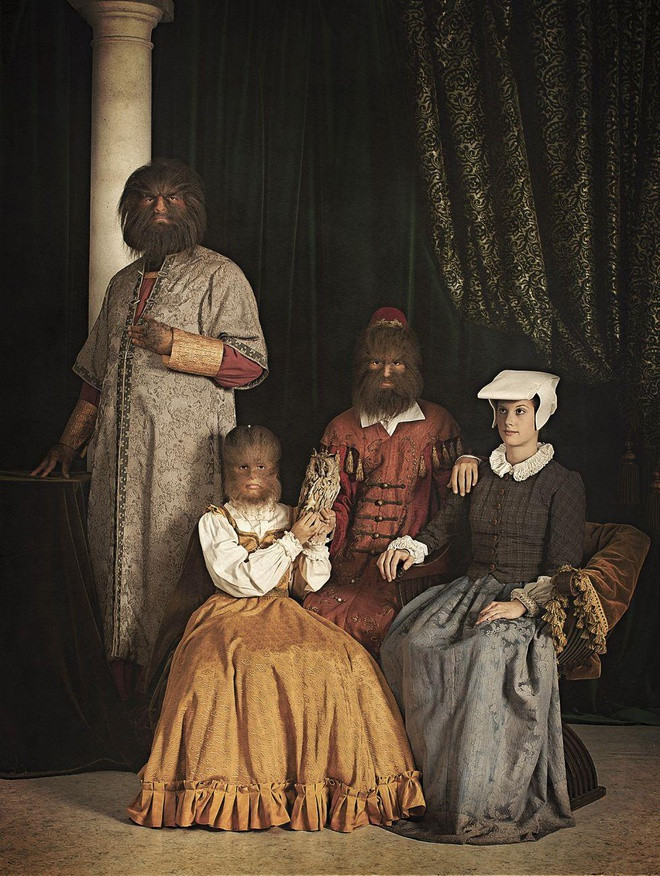 Vợ chồng Gonzalez có 2 người con trai đầu khỏe mạnh bình thường nhưng 4 người con tiếp theo đều có lông mọc rậm rạp như cha.