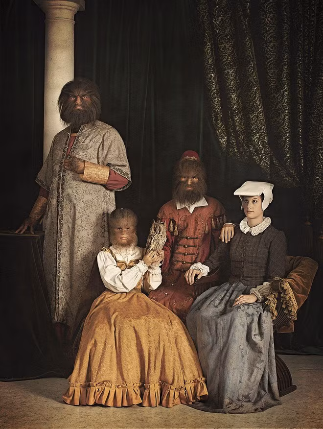 Vợ chồng Gonzalez có 2 người con trai đầu khỏe mạnh bình thường nhưng 4 người con tiếp theo đều có lông mọc rậm rạp như cha.