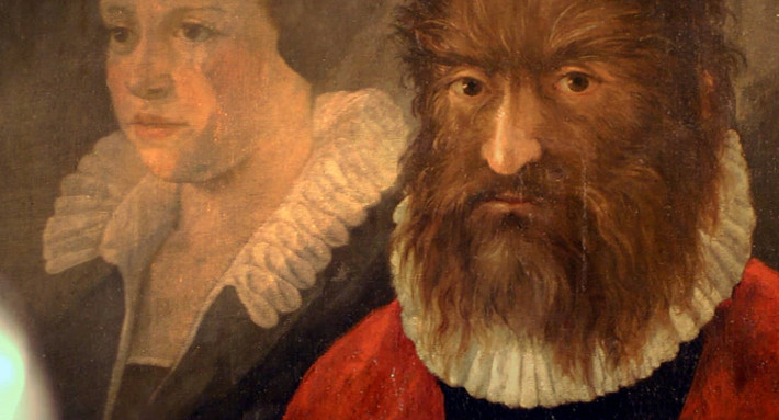 Thức ăn của "người sói" Gonzalez là thịt sống và các loài đồ ăn thừa dành cho chó mèo... Thậm chí, ông còn trở thành thú vui tiêu khiển cho giới quý tộc ở Tây Ban Nha.