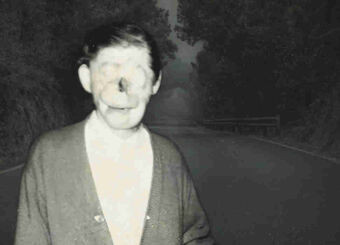 Dù không chết nhưng Ray bị thương nặng với gương mặt bị biến dạng khủng khiếp. Kể từ đó, cậu bé bị nhiều người xa lánh, kỳ thị, thậm chí không mấy người dám lại gần trò chuyện và chơi cùng.