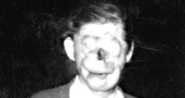 Ngay cả gia đình cũng xa lánh Ray khi không ngồi ăn cùng với con trai. Khi lớn lên, gia đình xây cho cậu một căn hộ nhỏ để sống riêng.