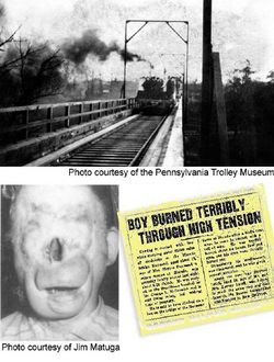 Vào tháng 8/1919, Ray, 8 tuổi, đi dạo cùng chị gái và vài người bạn ở New Castle, Pennsylvania. Khi thấy một tổ chim nằm cạnh toa xe lửa bỏ không, cậu bé muốn nhìn rõ nên trèo lên nhưng không may chạm tay vào dây điện và bị giật.