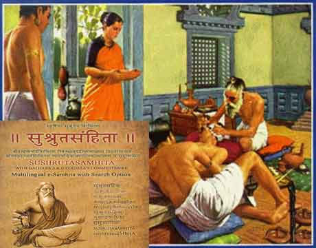 Phần da được nâng lên cao bằng cách chèn hai ống cây thầu dầu vào hai lỗ mũi để định hình hình dạng chiếc mũi sau khi phẫu thuật.