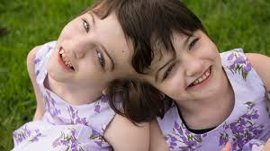 Điều này đồng nghĩa với việc Krista và Tatiana có thể biết được suy nghĩ và trải nghiệm của người kia. Kể từ khi chào đời cho đến này, cặp sinh đôi này học cách sinh hoạt bình thường với cơ thể đặc biệt.