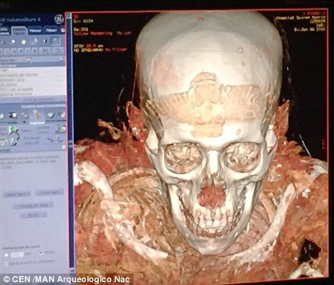 Ông là bác sĩ mắt phục vụ pharaoh Ai Cập Ptolemy II.