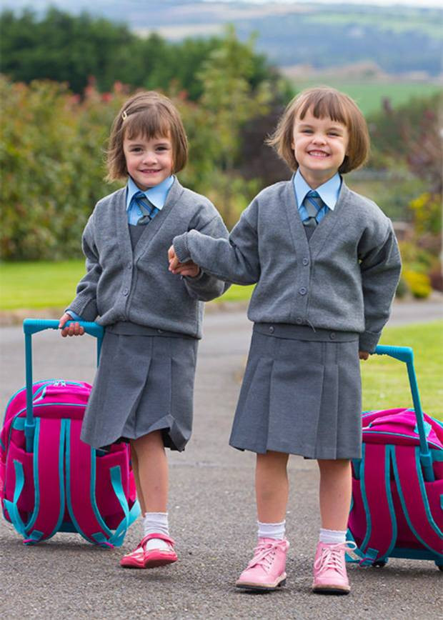 Cặp song sinh đặc biệt ấy là Amy và Katie sống ở Ireland. Mẹ của cặp song sinh này là Maria đã sinh em bé đầu tiên khi thai nhi mới được 24 tuần tuổi vào ngày 1/6/2012.