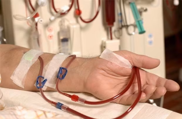 6. Sưng nề toàn bộ cơ thể: Bệnh nhân mắc bệnh thận hư thường có triệu chứng sưng phù toàn thân, nguyên nhân là do chức năng thận suy giảm, không thể thải kịp thời lượng nước dư thừa trong cơ thể ra ngoài. Nhìn chung, triệu chứng ban đầu chủ yếu là sưng mí mắt, mắt cá chân.