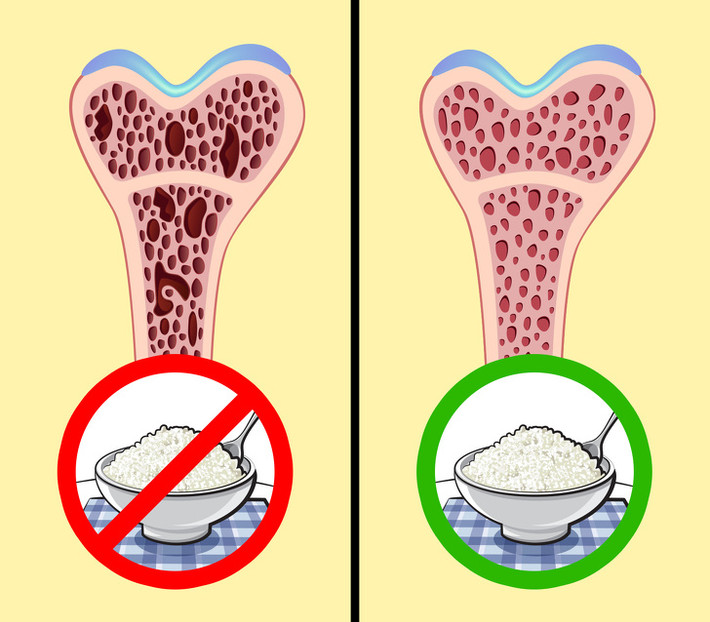 Xương khỏe hơn: Ăn phô mai giúp xương và răng của chúng ta sẽ trở nên mạnh mẽ hơn. Canxi trong phô mai có ảnh hưởng tích cực đến quá trình trao đổi chất và độ dày của mô xương. Ăn thực phẩm giàu canxi khi mang thai giúp giảm nguy cơ mắc bệnh loãng xương và ổn định hệ thần kinh.