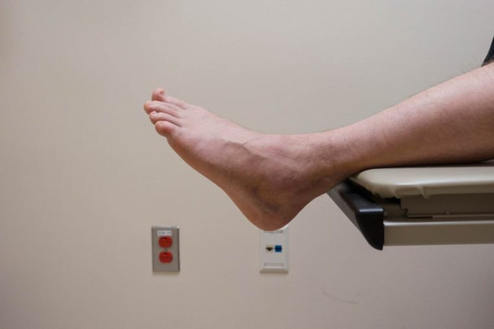 Bàn chân và chân của bạn bị sưng: Nếu bạn nhận thấy đột nhiên chân mình khó đút vào giày hoặc đeo tất thấy chật, đó có thể là một trong những dấu hiệu của bệnh tim.