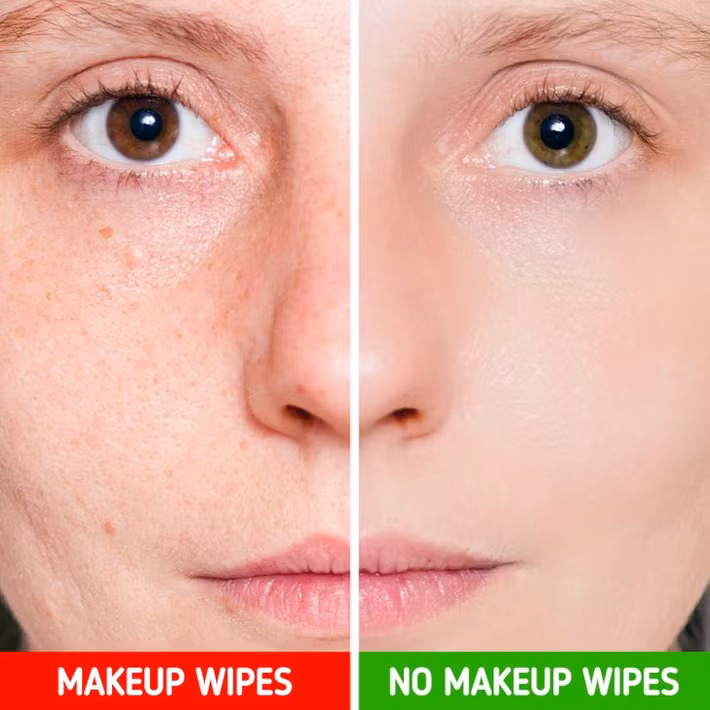 1. Dùng giấy ướt tẩy trang: Bản thân khăn lau trang điểm không gây ra mụn, nhưng chúng có thể để lại bụi bẩn và cặn trang điểm dẫn đến mụn. Các loại giấy ướt tẩy trang chắc chắn có chứa cồn, nước hoa và các thành phần dễ làm khô da. Nếu bạn có làn da bạn nhạy cảm, hành động chà xát sẽ làm tăng khả năng kích ứng da, sưng tấy, viêm nhiễm, tắc lỗ chân lông.