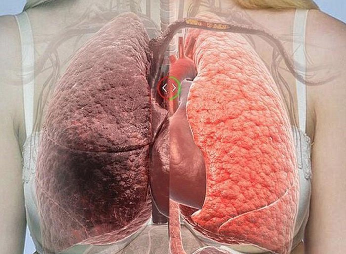 Bên cạnh đó, bạn cũng nên bổ sung những thực phẩm có tác dụng thanh lọc, giải độc, làm sạch phổi mạnh nhất mà chúng ta nên bổ sung nhiều hơn vào thực đơn ăn uống, đặc biệt là đối với người hút thuốc.