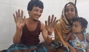 Mẹ của Bajandar nói về căn bệnh của con trai rằng đôi tay "của quỷ" khiến anh như sống trong "địa ngục".