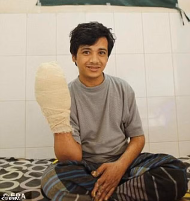 Kể từ năm 2016, Bajandar trải qua 25 ca phẫu thuật để gỡ bỏ gần 5kg “rễ cây” khỏi tay và chân.