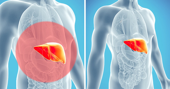 Nếu bạn thấy mình một số dấu hiệu mô tả ở trên, hãy nghĩ đến việc thải độc cho cơ thể. Trước mắt, hãy làm ngay những cách đơn giản nhất là thay đổi lối sống lành mạnh như uống nhiều nước để loại bỏ độc tố ra ngoài, luyện tập yoga, ăn thực phẩm sạch…