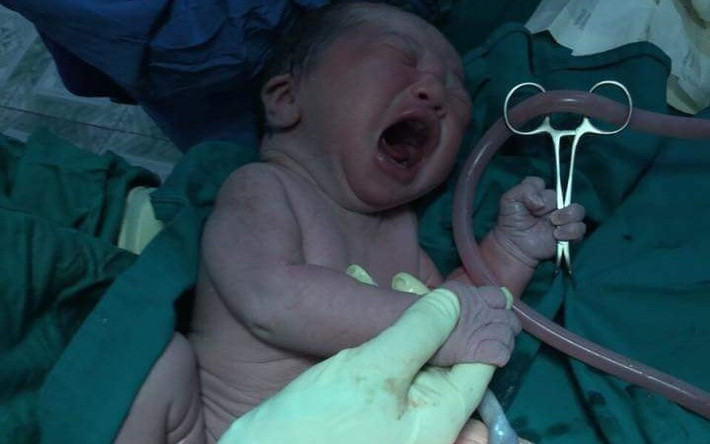 Trước đó, hình ảnh một em bé sơ sinh tay cầm kéo cũng khiến dân mạng thích thú. Em bé này có bố là 1 HLV võ cổ truyền. Và dường như được di truyền luôn nghề của bố, khi bác sĩ vừa đưa kéo vào để cắt dây rốn thì cậu bé đã "tước" luôn cây kéo phòng vệ như thật.