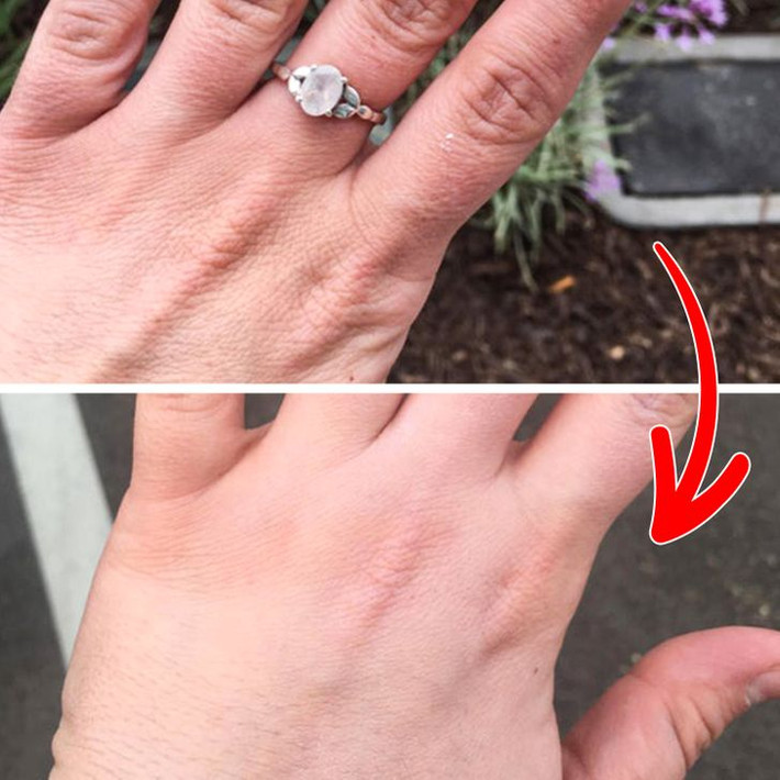 6. Thử dùng mỹ phẩm để làm sáng các vết thâm trên tay: Để làm mờ vết thâm trên tay, hãy thử các sản phẩm có chứa vitamin C, vì chất này có khả năng ngăn ngừa tăng sắc tố. Cẩn thận với các sản phẩm làm sáng da có chứa thủy ngân vì chúng cực kỳ nguy hại cho sức khỏe của bạn.