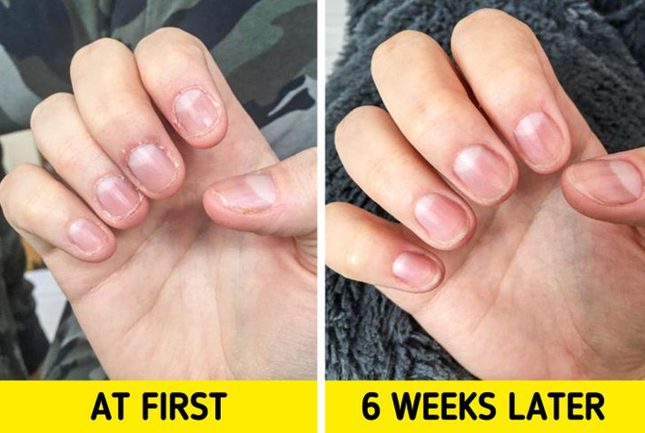 7. Đặc biệt chú ý đến lớp biểu bì của bạn: Lớp biểu bì khô sẽ khiến tay bạn trông không được gọn gàng. Một cách để thay đổi đáng kể diện mạo của đôi tay là dưỡng ẩm cho lớp biểu bì trên bàn tay. Hãy sử dụng các sản phẩm dưỡng ẩm đặc biệt, hoặc thậm chí là dầu ô liu để mát xa bàn tay.