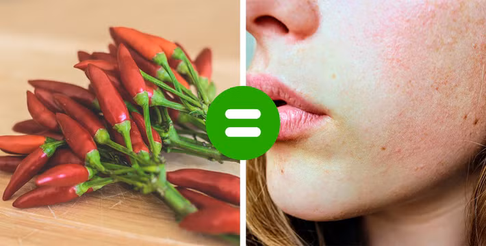 Thực phẩm cay gây đỏ và bọng mắt: Thực phẩm cay có thể gây ra bệnh hồng ban trên da vì nó làm giãn các mạch máu. Ăn cay thường xuyên có thể dẫn đến tĩnh mạch mạng nhện, bọng mắt hoặc da đỏ vĩnh viễn. Ảnh: BS.