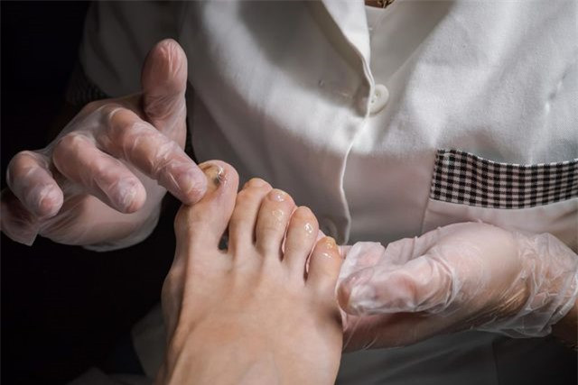 Đốm trắng trên móng tay: Có hai loại đốm trắng: leukonychia thực (đốm trắng nằm trên móng) và leukonychia rõ (đốm trắng trông giống như nằm trên móng, nhưng thực ra lại nằm ở lớp da bên dưới móng). Leukonychia thực có thể là dấu hiệu của ngộ độc asen hoặc kim loại nặng, mặc dù khá hiếm gặp.