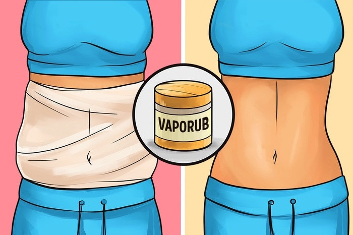 Làm mờ vết rạn da bằng Vaporub: Kem mỡ Vaporub chứa các thành phần có khả năng làm mềm da, tái tạo các vết rạn, nứt da. Cách làm: Thoa một lớp Vaporub lên vùng da bị rạn nứt, quấn nilon qua đêm. Ngoài ra cũng có thể áp dụng cách này khi tập luyện để tăng khả năng đốt cháy mỡ. Ảnh: BS.