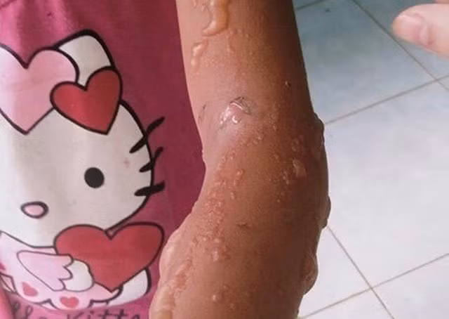 Bất ngờ với bọ 3 sọc có độc tố nhưng thương lái thu mua giá 2 triệu/kg - Hình 4 Bat ngo voi bo 3 soc co doc to nhung thuong lai thu mua gia 2 trieu/kg-Hinh-4