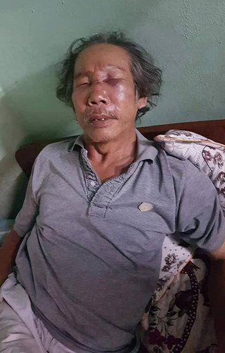 Cơ quan CSĐT Công an quận Thủ Đức đang tạm giữ bảo vệ đánh người; đồng thời tiến hành trưng cầu giám định thương tích đối với nạn nhân. Cơ quan CSĐT Công an quận Thủ Đức đang tạm giữ bảo vệ đánh người; đồng thời tiến hành trưng cầu giám định thương tích đối với nạn nhân.