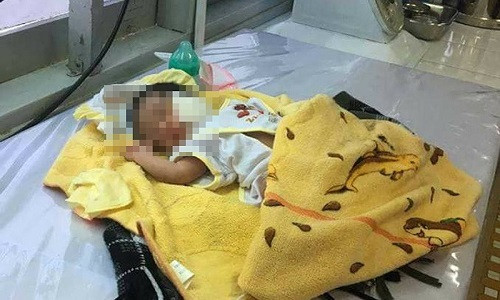 Cháu bé được cứu sống. Ảnh: KN Cháu bé được cứu sống. Ảnh: KN