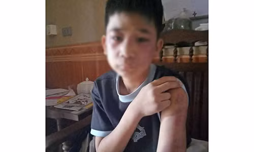 Cháu H. bị bố đẻ và mẹ kế đánh đập chỉ vì những lỗi nhỏ.