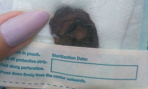 Cô gái suýt chết vì cắt thứ không ngờ... làm quà tặng bạn trai Co gai suyt chet vi cat thu khong ngo... lam qua tang ban trai