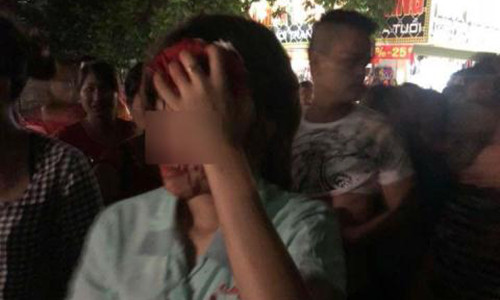 Xót xa người vợ bị chồng đánh đến chảy máu đầu phải nhập viện Xot xa nguoi vo bi chong danh den chay mau dau phai nhap vien